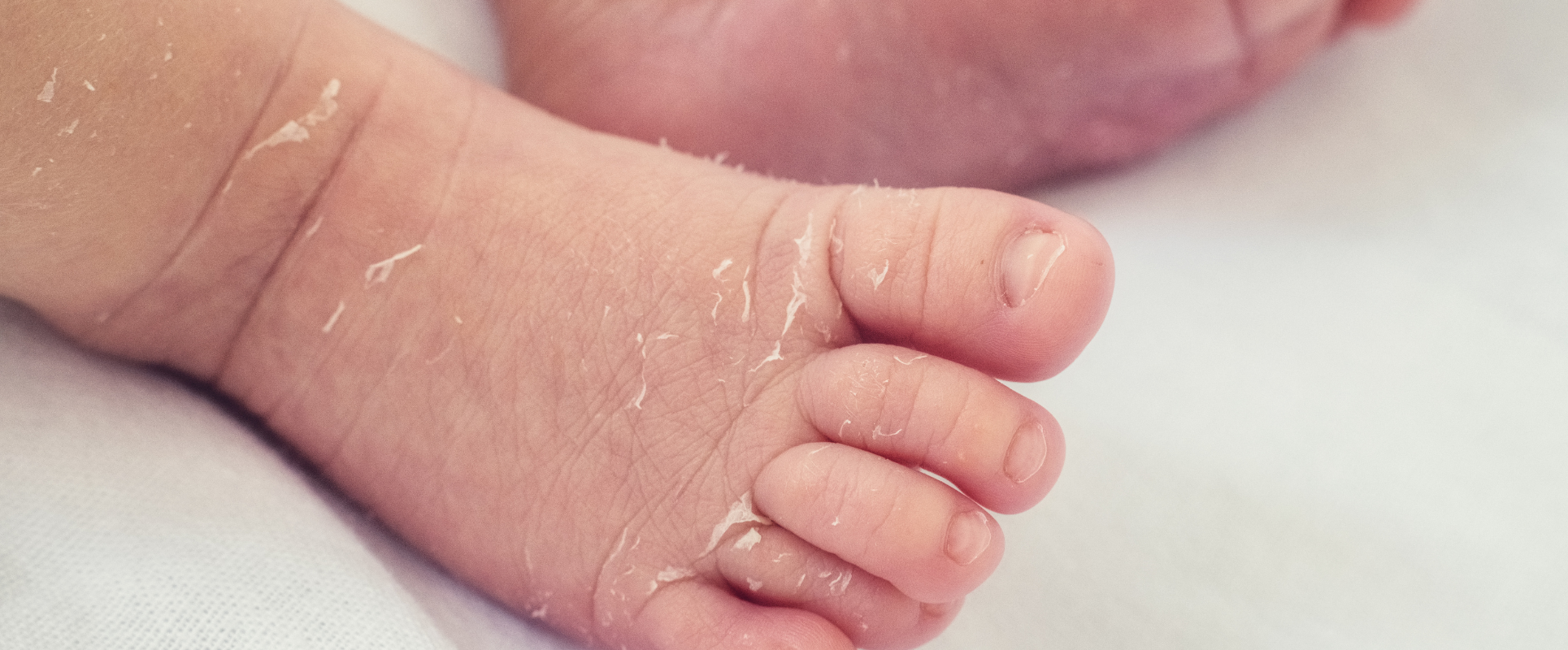 Dry Baby Skin: Causes, Common Mistakes & How to Moisturize Safely